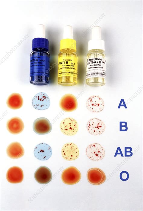 one drop of blood test results